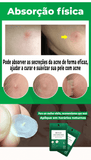 AcneStick© Adesivo de Hidrocoloide