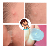 AcneStick© Adesivo de Hidrocoloide